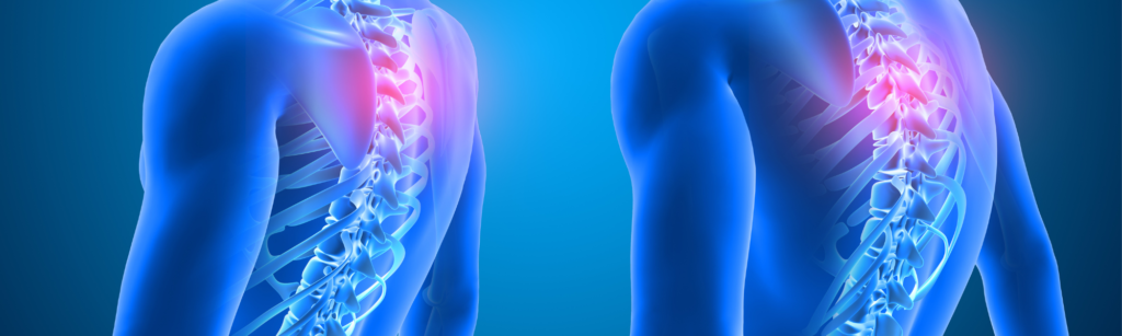 Impact of Technology on Posture & How Chiropractic Can Help